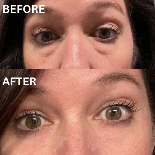 Peptide Collagen Hydrogel Eye Patch