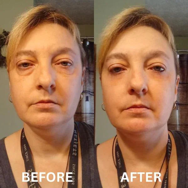 Peptide Collagen Hydrogel Eye Patch