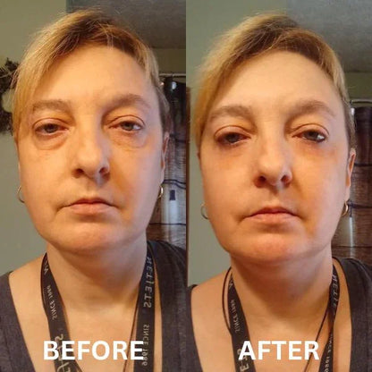 Peptide Collagen Hydrogel Eye Patch
